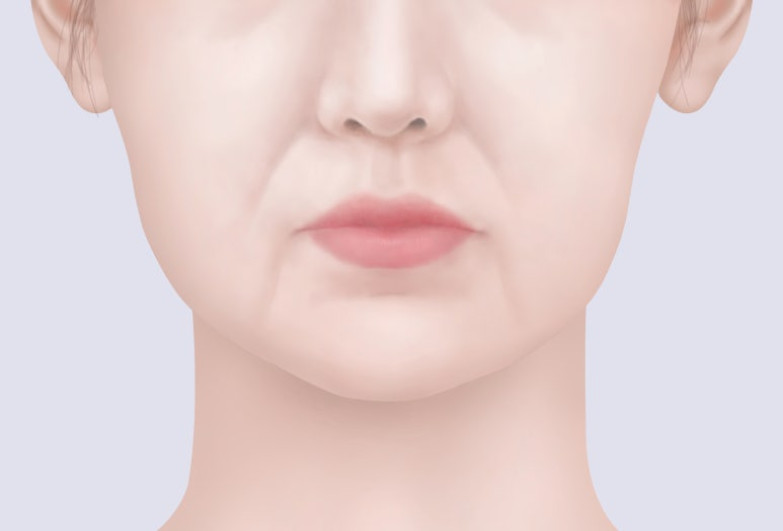 Mysterious appearance