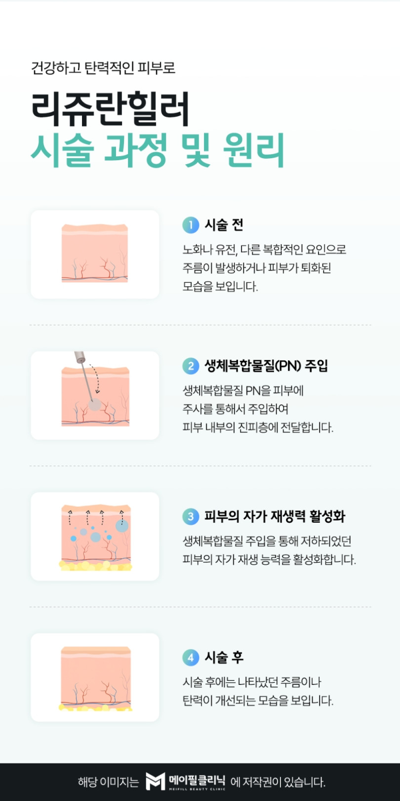 인상 깊은 모습