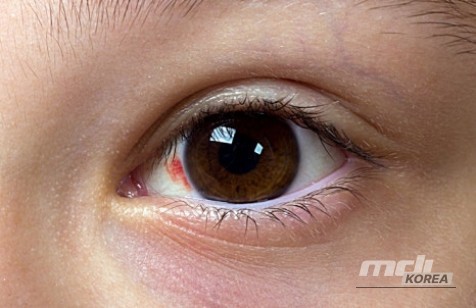 흥미로운 이미지