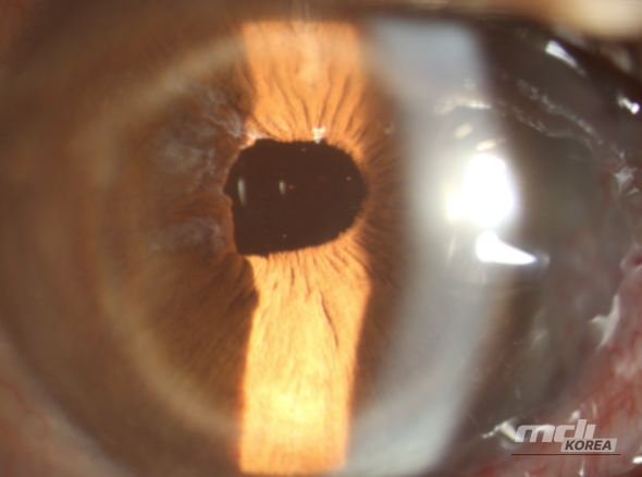 인상 깊은 모습