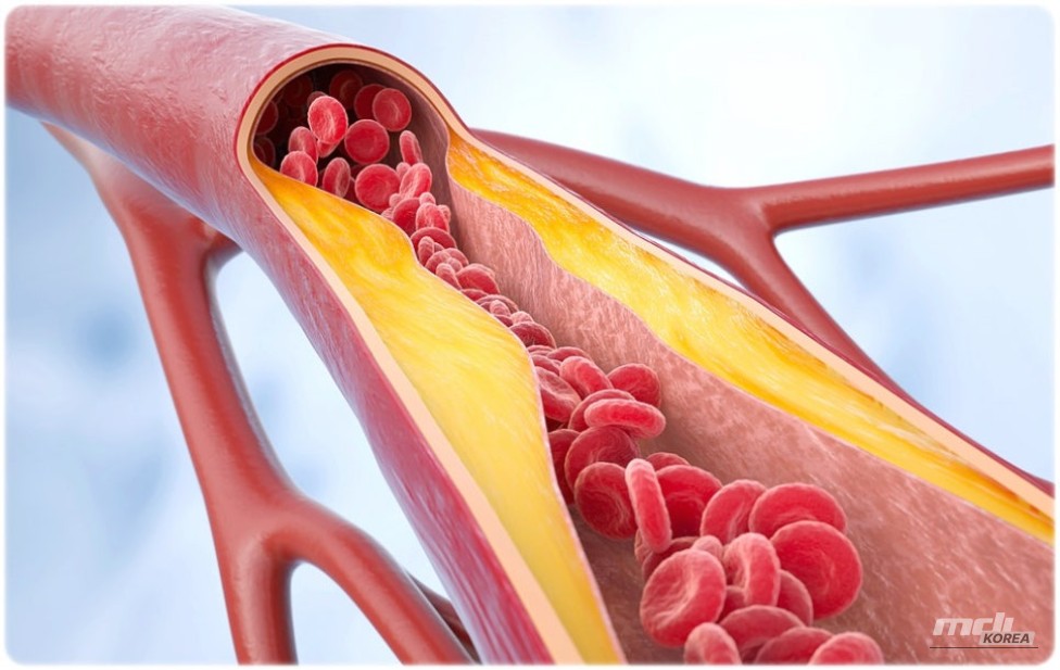 인상 깊은 모습