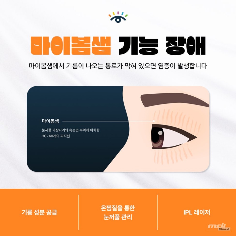 매력적인 사진