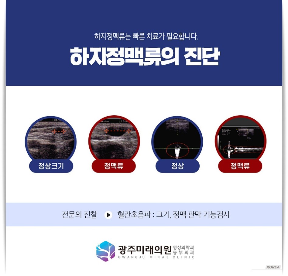 매력적인 사진