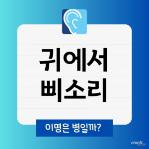 특별한 순간