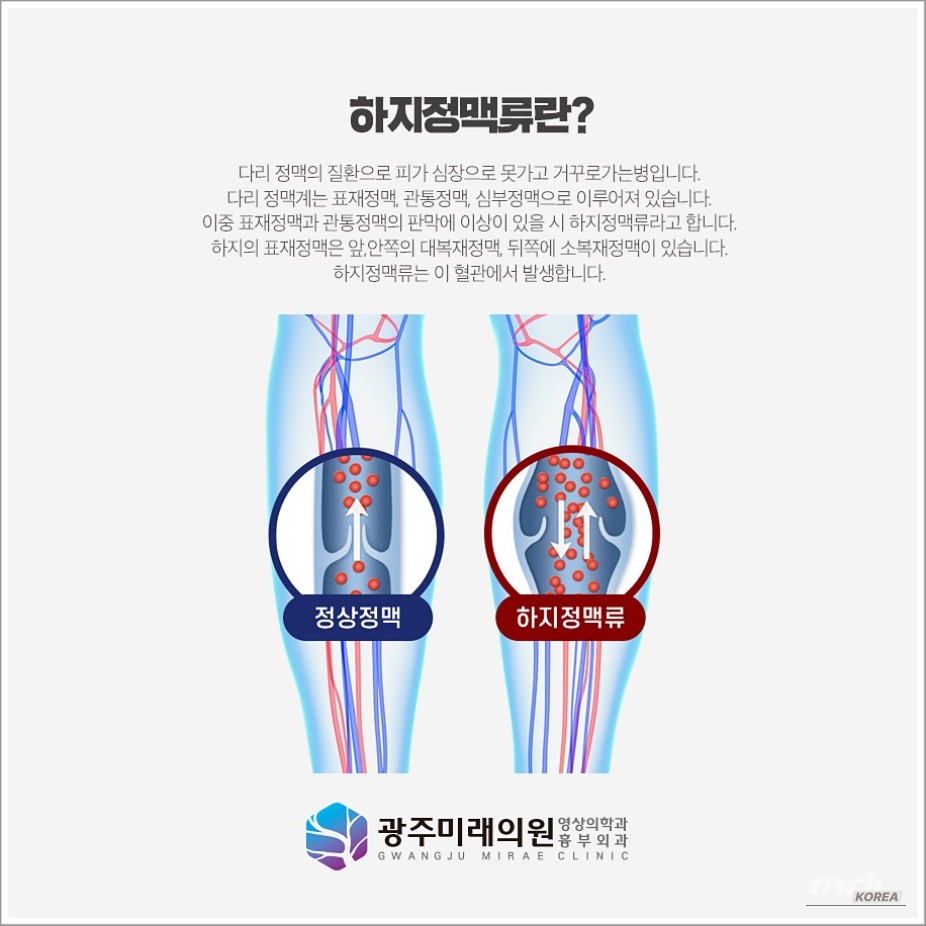 꿈같은 순간