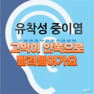 특별한 순간